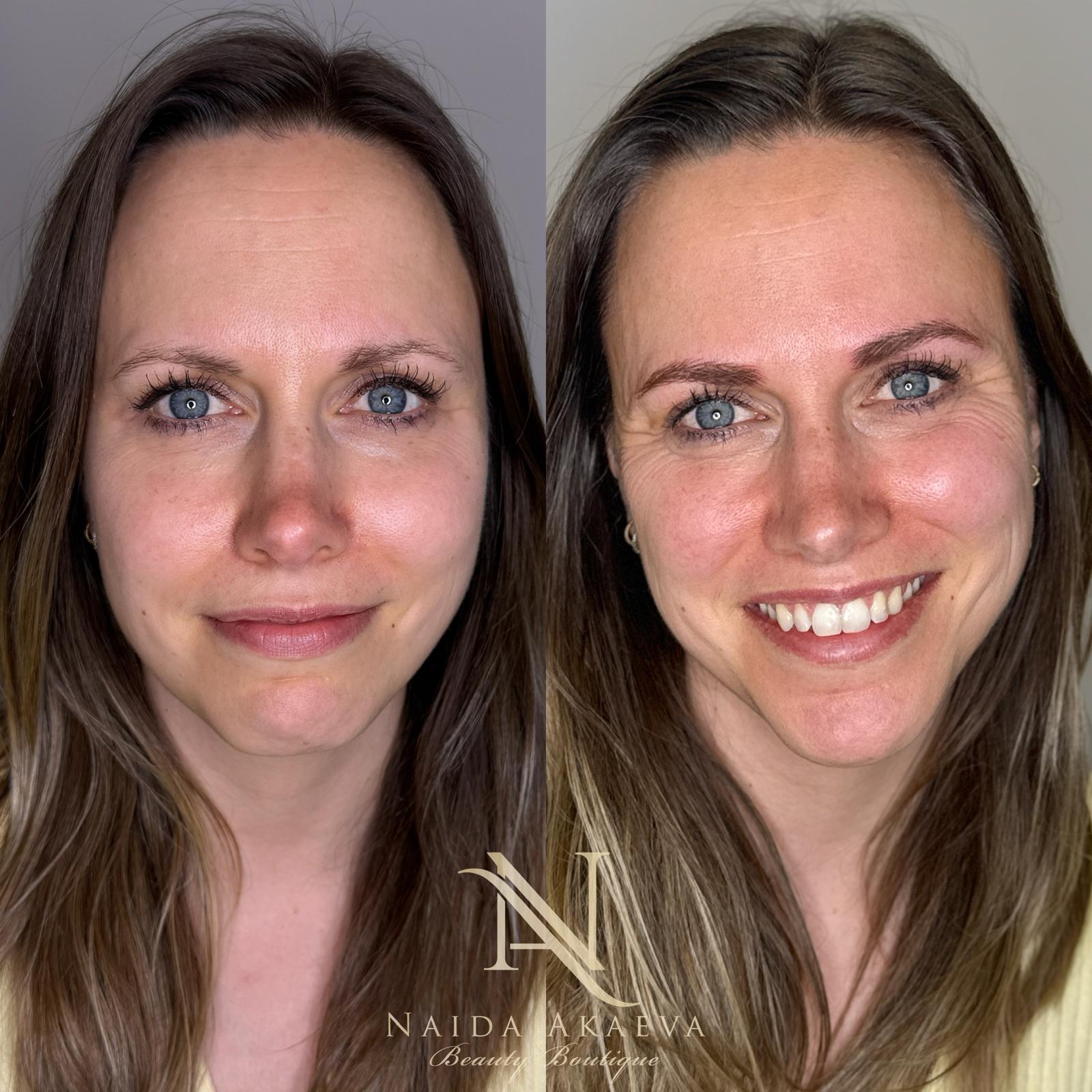 Realism Brows